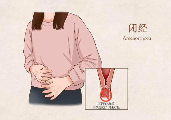 闭经